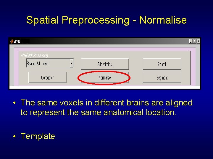 Spatial Preprocessing - Normalise • The same voxels in different brains are aligned to