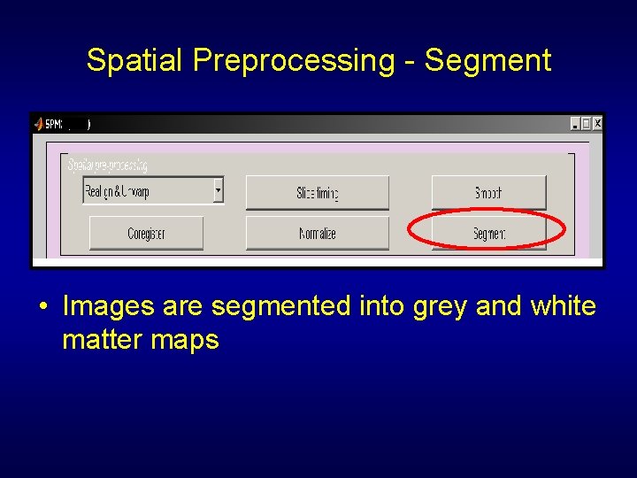 Spatial Preprocessing - Segment • Images are segmented into grey and white matter maps