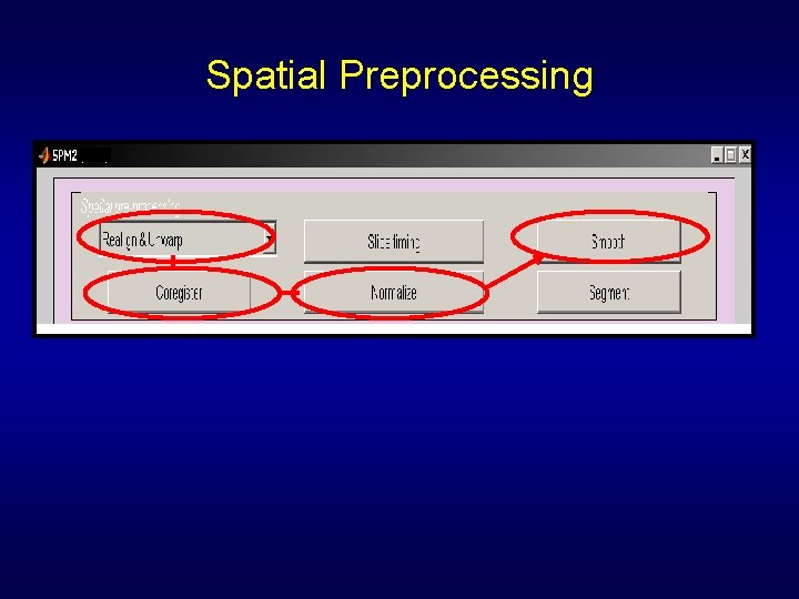 Spatial Preprocessing 