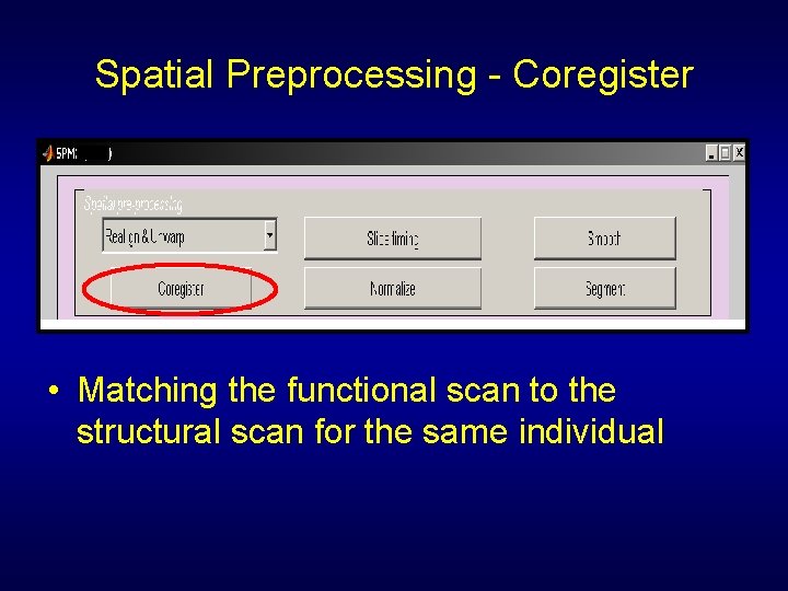 Spatial Preprocessing - Coregister • Matching the functional scan to the structural scan for
