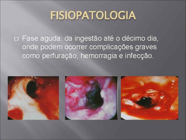 FISIOPATOLOGIA � Fase aguda: da ingestão até o décimo dia, onde podem ocorrer complicações