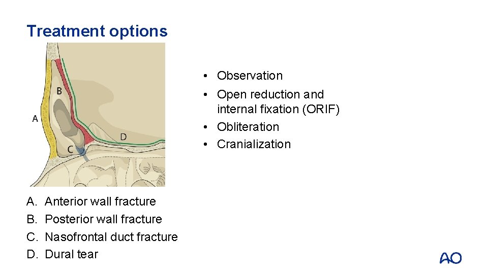 Treatment options • Observation • Open reduction and internal fixation (ORIF) • Obliteration •