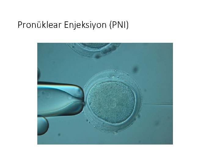 Pronüklear Enjeksiyon (PNI) 