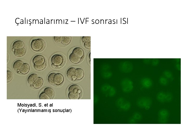 Çalışmalarımız – IVF sonrası ISI Moisyadi, S. et al (Yayınlanmamış sonuçlar) 