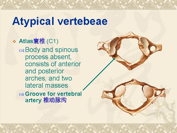 Atypical vertebeae v Atlas寰椎 (C 1) Body and spinous process absent, consists of anterior