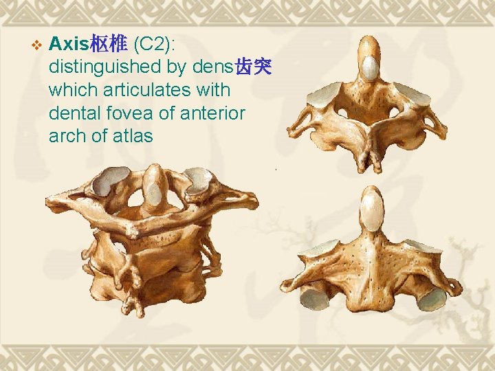 v Axis枢椎 (C 2): distinguished by dens齿突 which articulates with dental fovea of anterior