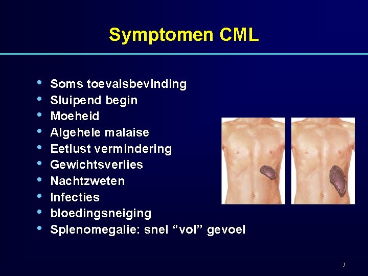 Symptomen CML • • • Soms toevalsbevinding Sluipend begin Moeheid Algehele malaise Eetlust vermindering