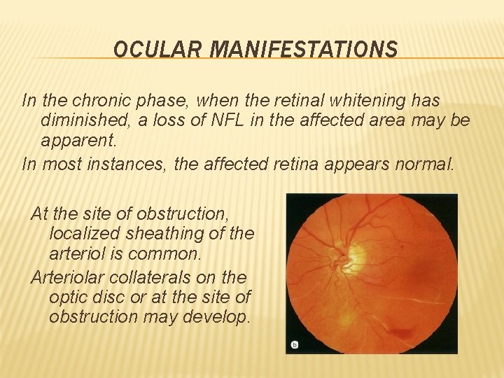 OCULAR MANIFESTATIONS In the chronic phase, when the retinal whitening has diminished, a loss