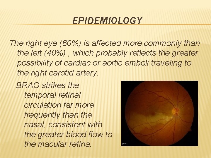 EPIDEMIOLOGY The right eye (60%) is affected more commonly than the left (40%) ,