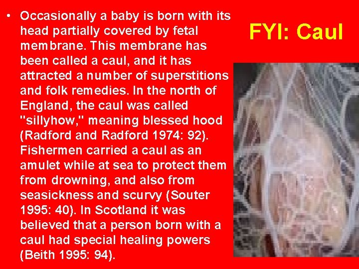 • Occasionally a baby is born with its head partially covered by fetal