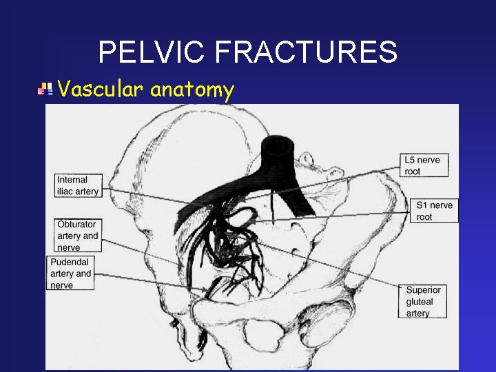 PELVIC FRACTURES Vascular anatomy 