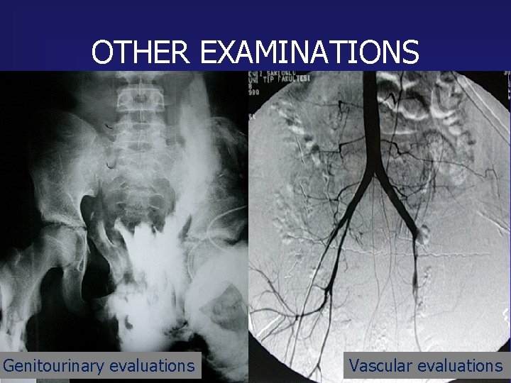 OTHER EXAMINATIONS Genitourinary evaluations Vascular evaluations 