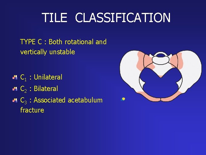 TILE CLASSIFICATION TYPE C : Both rotational and vertically unstable C 1 : Unilateral