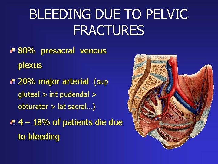 BLEEDING DUE TO PELVIC FRACTURES 80% presacral venous plexus 20% major arterial (sup gluteal