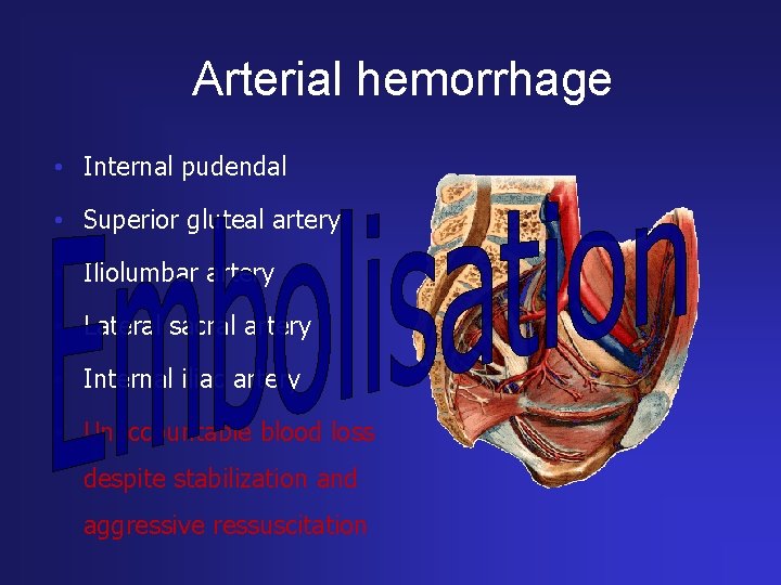 Arterial hemorrhage • Internal pudendal • Superior gluteal artery • Iliolumbar artery • Lateral