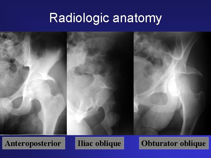 Radiologic anatomy Anteroposterior Iliac oblique Obturator oblique 
