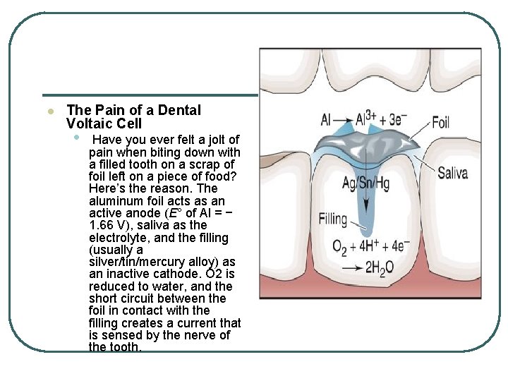 l The Pain of a Dental Voltaic Cell • Have you ever felt a