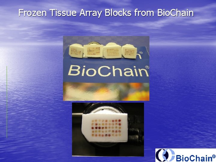 Frozen Tissue Array Blocks from Bio. Chain 