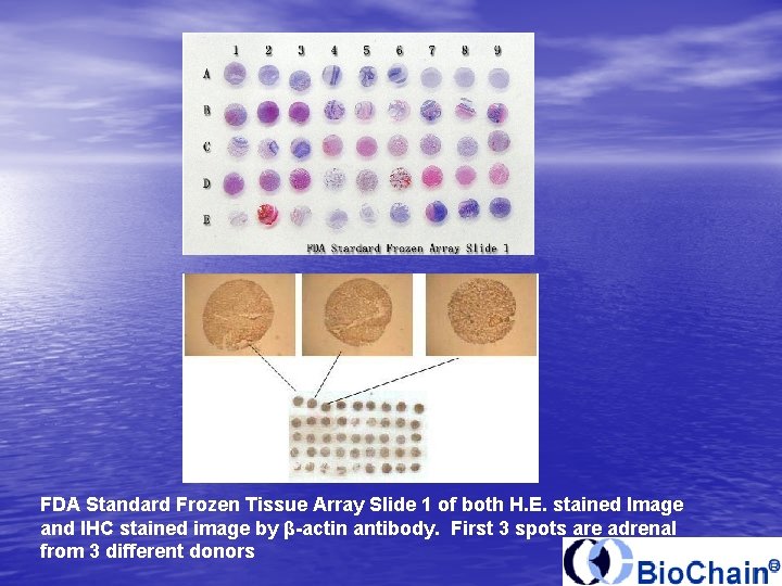 FDA Standard Frozen Tissue Array Slide 1 of both H. E. stained Image and
