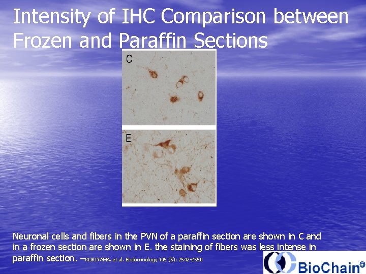 Intensity of IHC Comparison between Frozen and Paraffin Sections Neuronal cells and fibers in