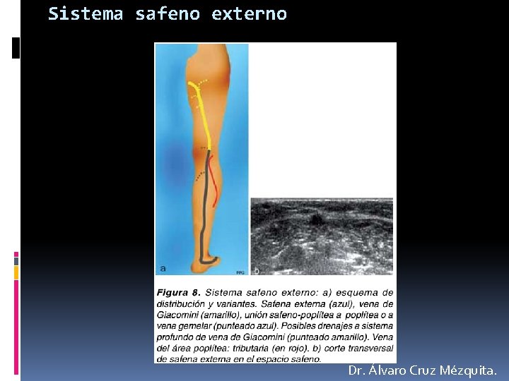 Sistema safeno externo Dr. Álvaro Cruz Mézquita. 