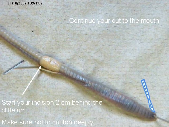 Continue your cut to the mouth Start your incision 2 cm behind the clittelum.