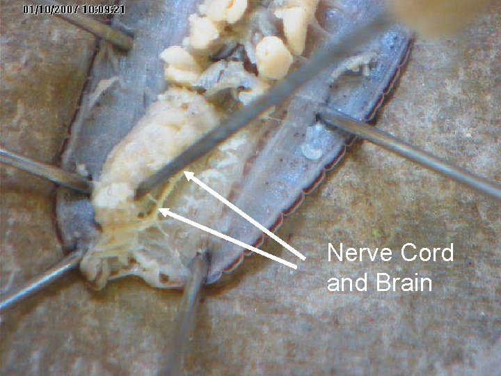 Nerve Cord and Brain 