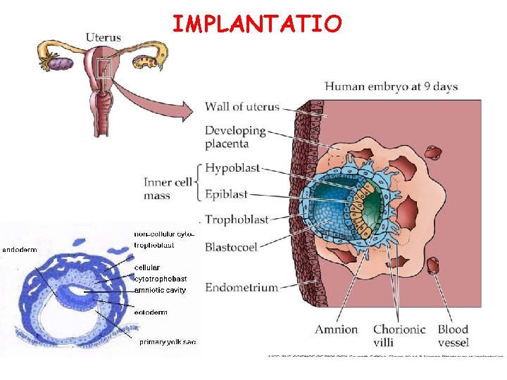 IMPLANTATIO 