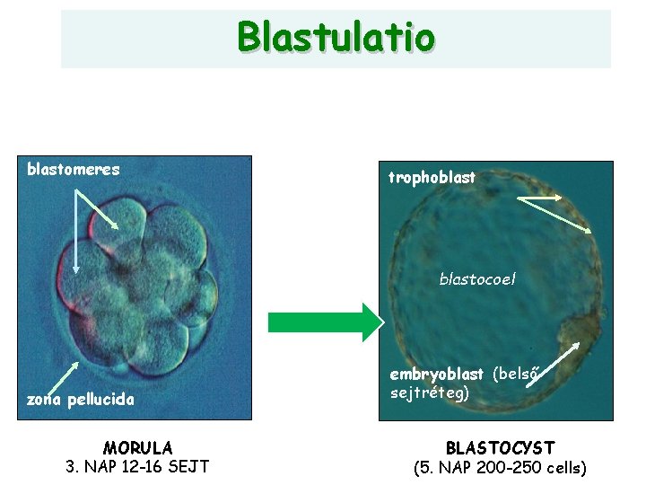 Blastulatio blastomeres trophoblastocoel zona pellucida MORULA 3. NAP 12 -16 SEJT embryoblast (belső sejtréteg)