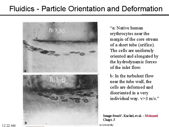Fluidics - Particle Orientation and Deformation “a: Native human erythrocytes near the margin of
