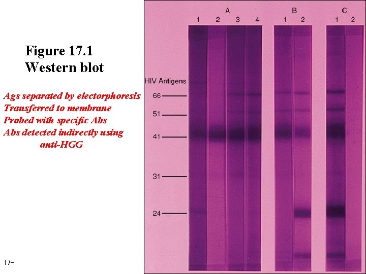 Figure 17. 1 Western blot Ags separated by electorphoresis Transferred to membrane Probed with
