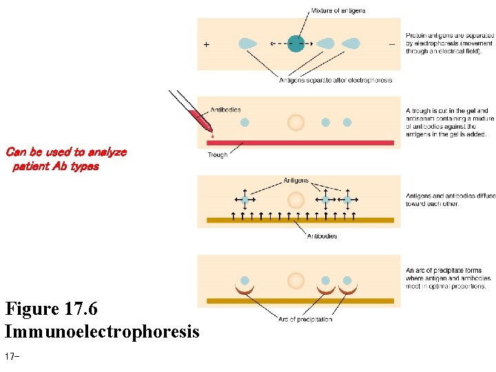 Can be used to analyze patient Ab types Figure 17. 6 Immunoelectrophoresis 17 -