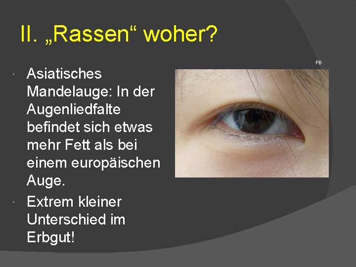 II. „Rassen“ woher? Asiatisches Mandelauge: In der Augenliedfalte befindet sich etwas mehr Fett als