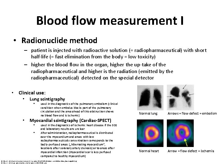 Blood flow measurement I • Radionuclide method – patient is injected with radioactive solution