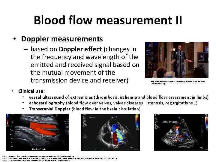 Blood flow measurement II • Doppler measurements – based on Doppler effect (changes in