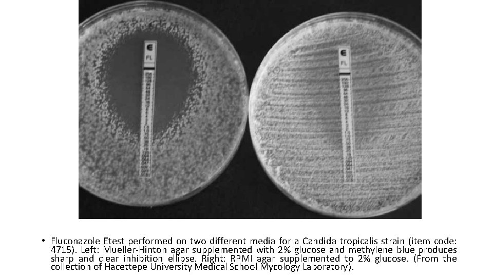  • Fluconazole Etest performed on two different media for a Candida tropicalis strain