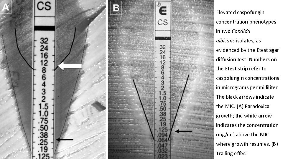 Elevated caspofungin concentration phenotypes in two Candida albicans isolates, as evidenced by the Etest