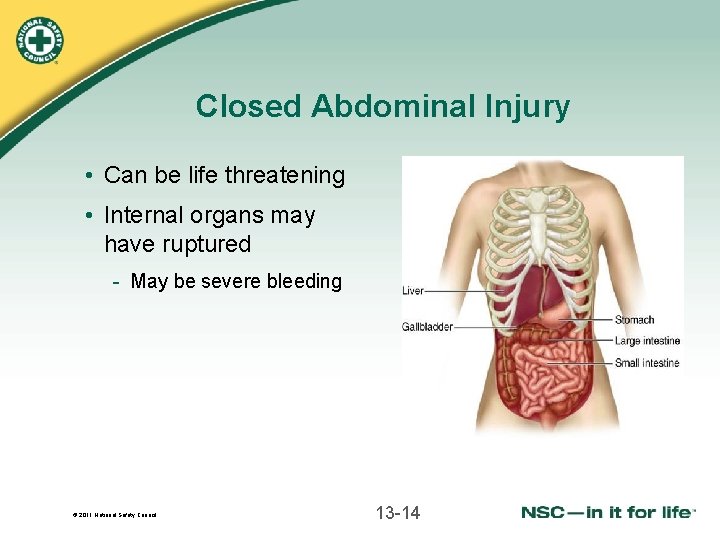Closed Abdominal Injury • Can be life threatening • Internal organs may have ruptured