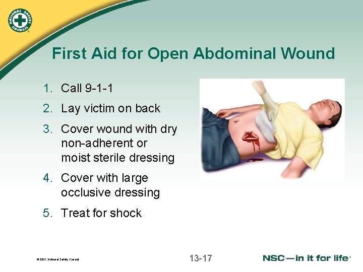 First Aid for Open Abdominal Wound 1. Call 9 -1 -1 2. Lay victim