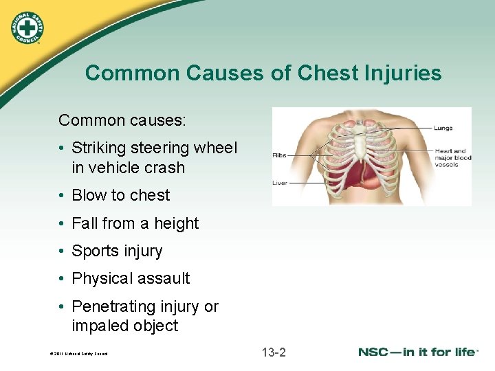 Common Causes of Chest Injuries Common causes: • Striking steering wheel in vehicle crash
