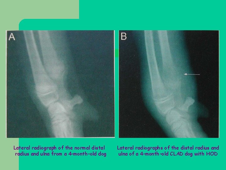 Lateral radiograph of the normal distal radius and ulna from a 4 -month-old dog