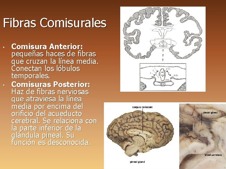 Fibras Comisurales • • Comisura Anterior: pequeñas haces de fibras que cruzan la línea