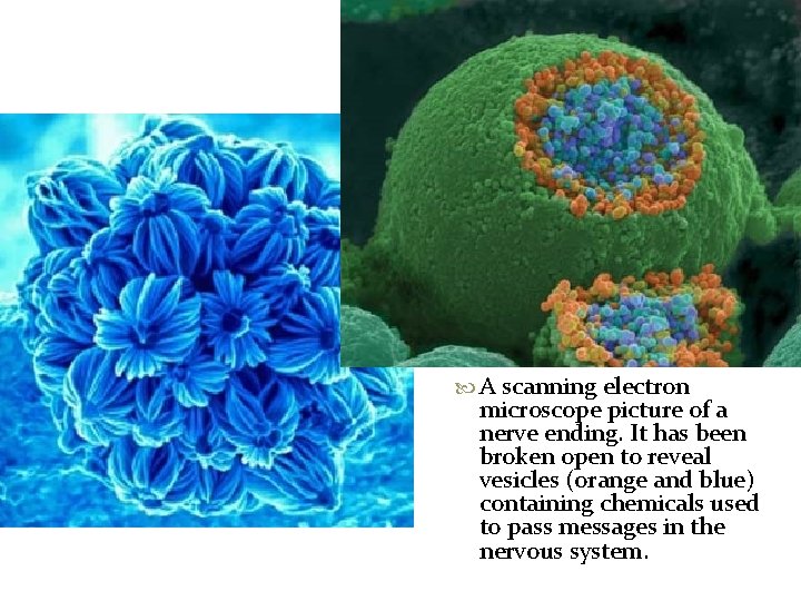  A scanning electron microscope picture of a nerve ending. It has been broken