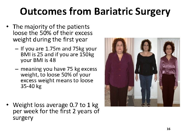 Outcomes from Bariatric Surgery • The majority of the patients loose the 50% of