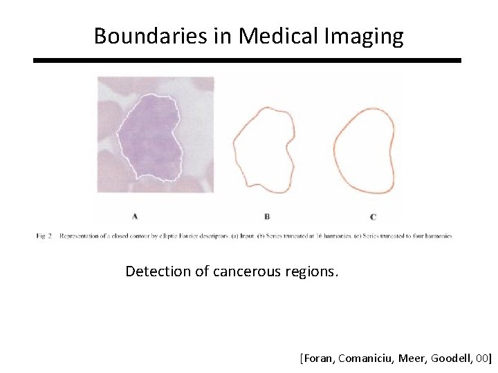 Boundaries in Medical Imaging Detection of cancerous regions. [Foran, Comaniciu, Meer, Goodell, 00] 
