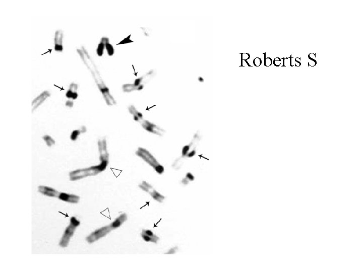 Roberts S 