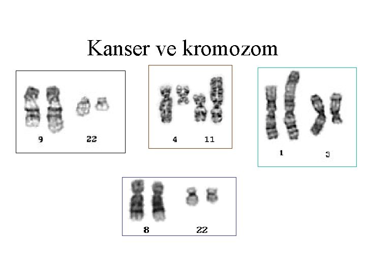 Kanser ve kromozom 