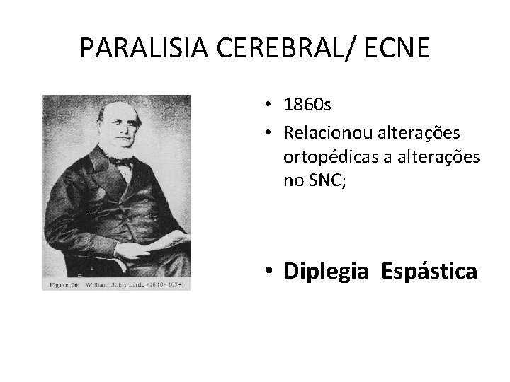 PARALISIA CEREBRAL/ ECNE • 1860 s • Relacionou alterações ortopédicas a alterações no SNC;