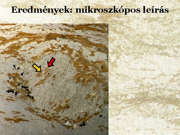 Eredmények: mikroszkópos leírás 