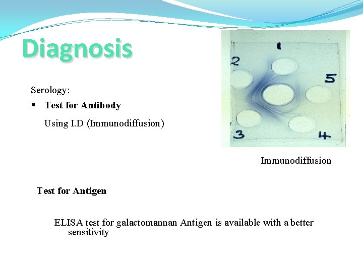 Diagnosis Serology: § Test for Antibody Using I. D (Immunodiffusion) Immunodiffusion Test for Antigen